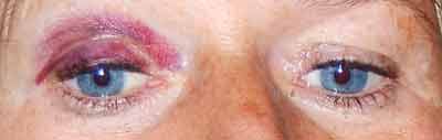 Auge.jpg